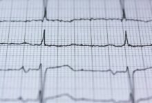stellar fusion energy release